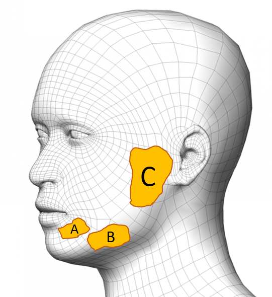 Imagen de las glándulas salivales. glándula A: Sublingual, glándula B: Submandibular y glándula C: Parótida